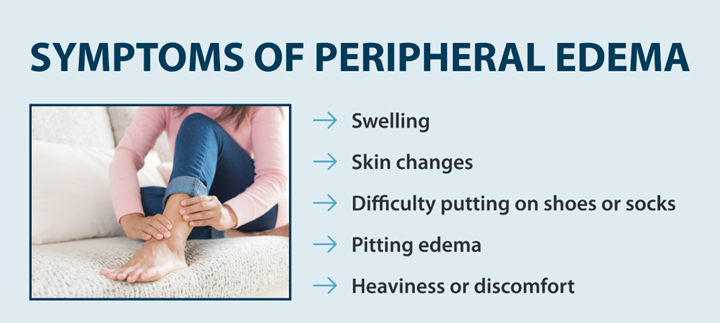 symptoms of peripheral edema Swelling, Skin changes, Difficulty putting on shoes or socks, Pitting edema, Heaviness or discomfort
