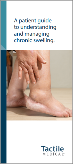 chronic swelling brochure thumbnail